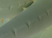 Fig. 1: Rough epidermis of a young leaf.